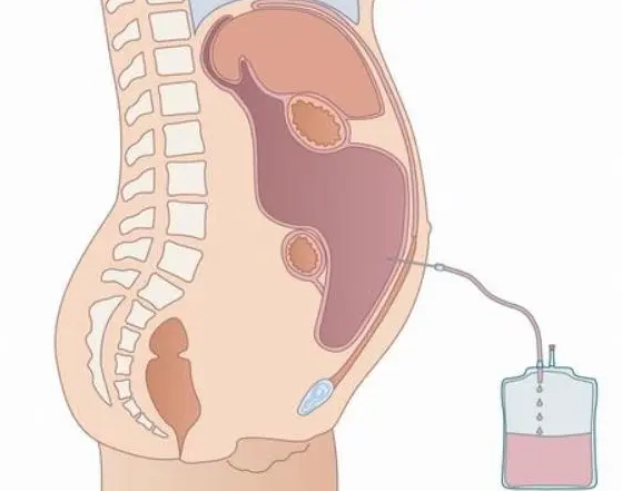 1709195444.png QQ浏览器截图20240229162908.png